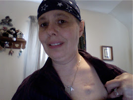 My port where chemotherapy was I-V administered