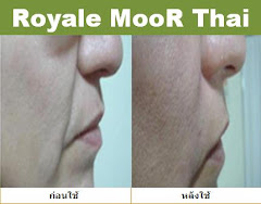 ผู้ใช้ Royale Moor Thai 8
