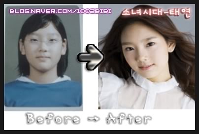 Lee+joo+yeon+plastic+surgery