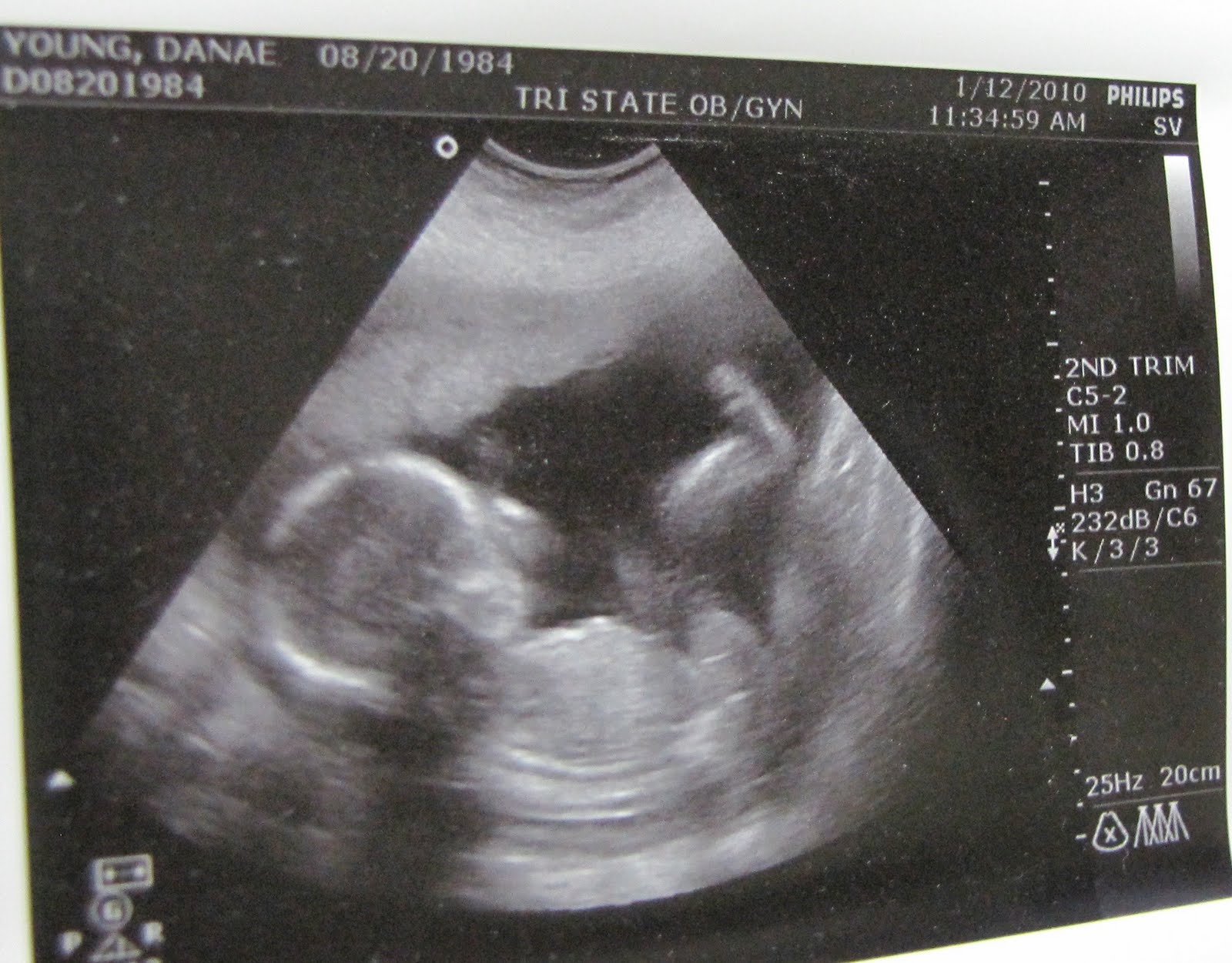 [ultrasound+baby+#2+(girl).JPG]