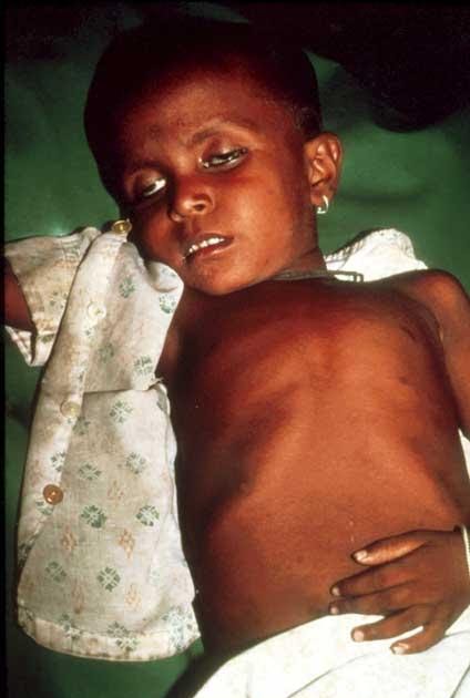 From the Grandma's Purse: How to get cured of diarrhoea - 1