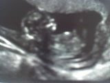Littlest J Pre-Birth