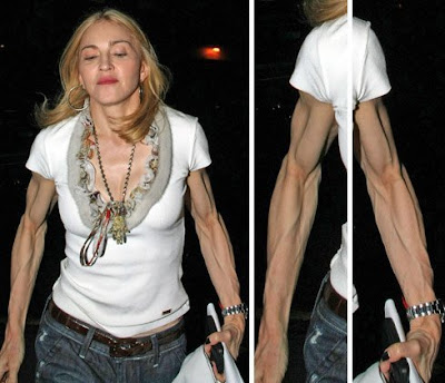 [http://1.bp.blogspot.com/_W6NKM9wLprM/Sm8P7L1nODI/AAAAAAAABIY/pO0NsAOPIu0/s400/madonna+arms.jpg]
