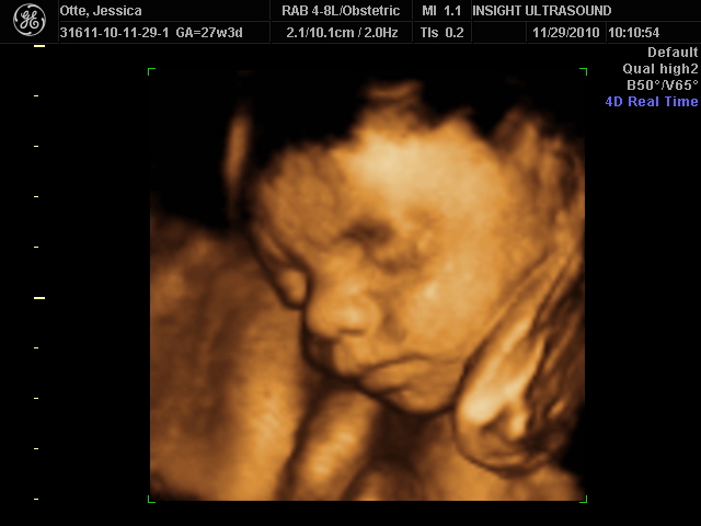40 Weeks And Counting 27 Weeks 4d Fetal Echo