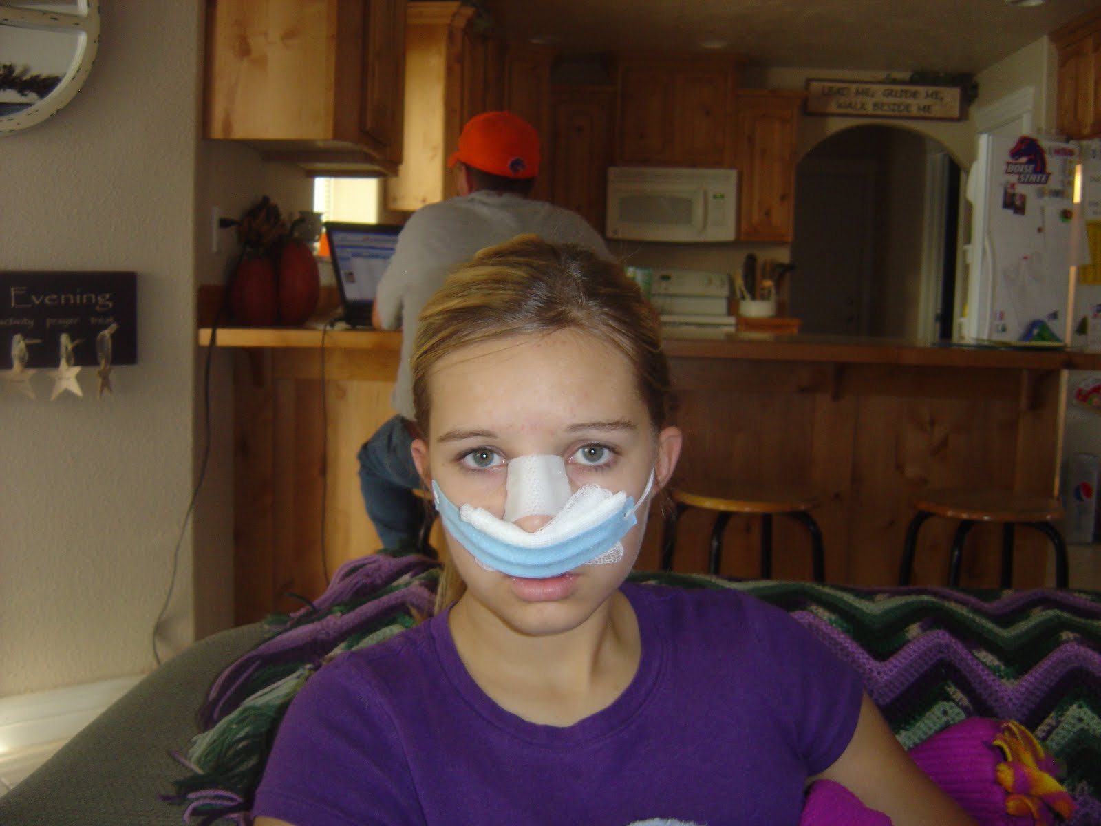 Brookie Bee Nose Surgery or Nose Job (as some may call it)