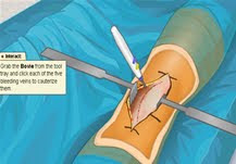 Virtual Knee Surgery
