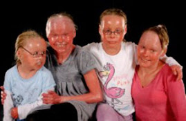 Un peeling por favor!!!