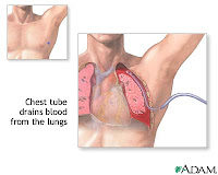 Ct+scan+abdomen+pelvis