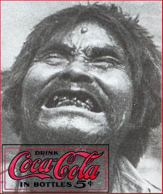 [tooth_decay_coca-cola.jpg]