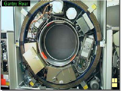 Ct+scanner+gantry