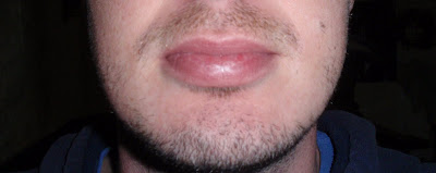 lips shrink age