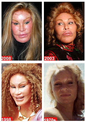 CatWomanPlasticSurgery.jpg