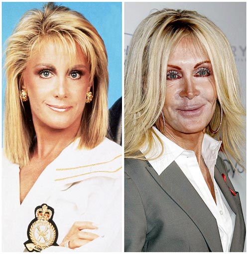 amerie nose job. Joan Van Ark Bad Nose Jobs