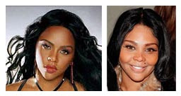Lil Kim Before And After Plastic Surgery