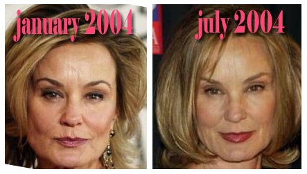 [JessicaLangePlasticSurgery.jpg]
