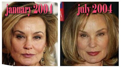 Jessica Lange Plastic Surgery