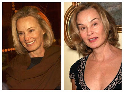 Jessica Lange Plastic Surgery