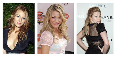 Blake Lively on Blake Lively Nose Job Before And After