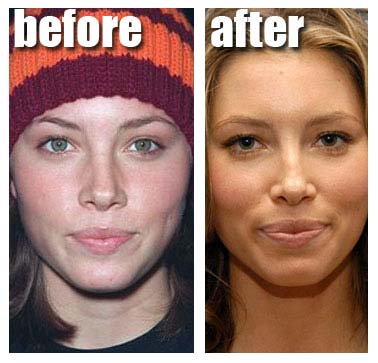   Free Plastic Surgery Makeover on Tori Amos Plastic Surgery Pictures