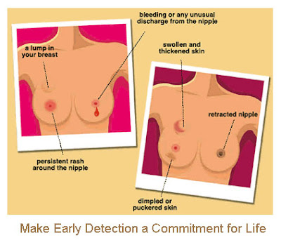 Breast Cancer Symptoms