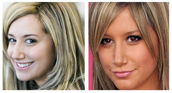 before and after nose jobs celebrity. Ashley Tisdale Nose Job Before