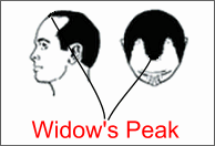 widows peak