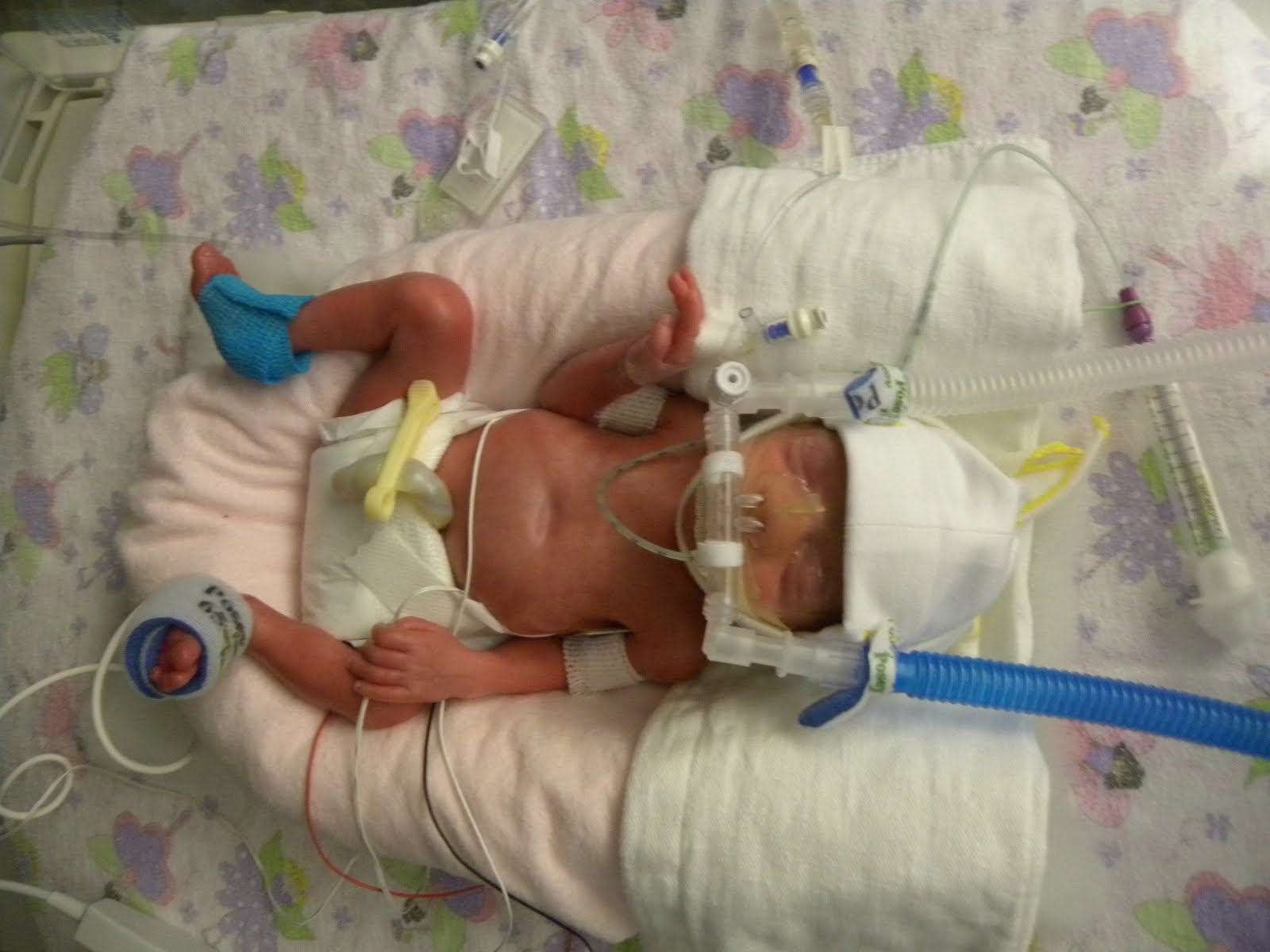 What is a cpap machine for infants, cognitive behavioural therapy for