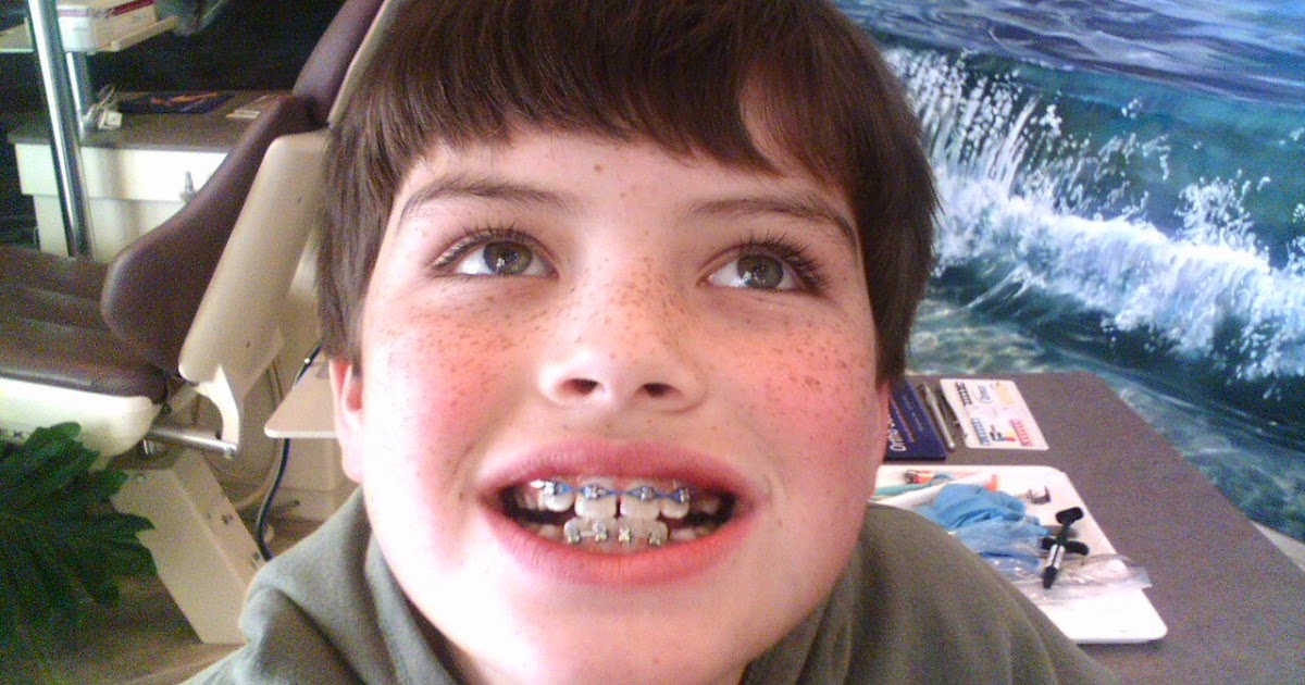 Melody's Doodles Breaking braces and rules