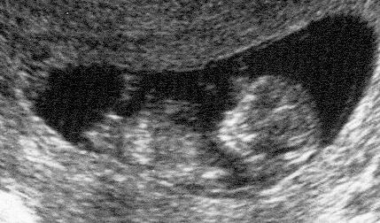 [babyultras.JPG]