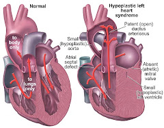 American Heart Association