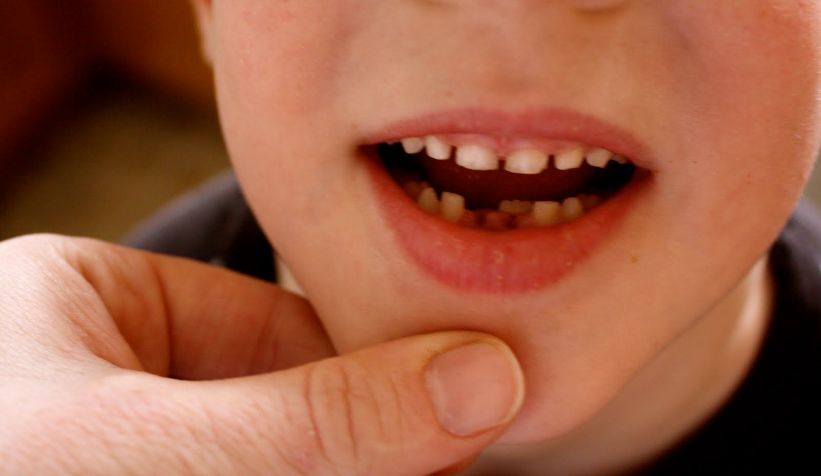 ~sWeeT DreaMs aRe MaDe Of tHeSe~: tHe StOrY oF sHaRk ToOTh