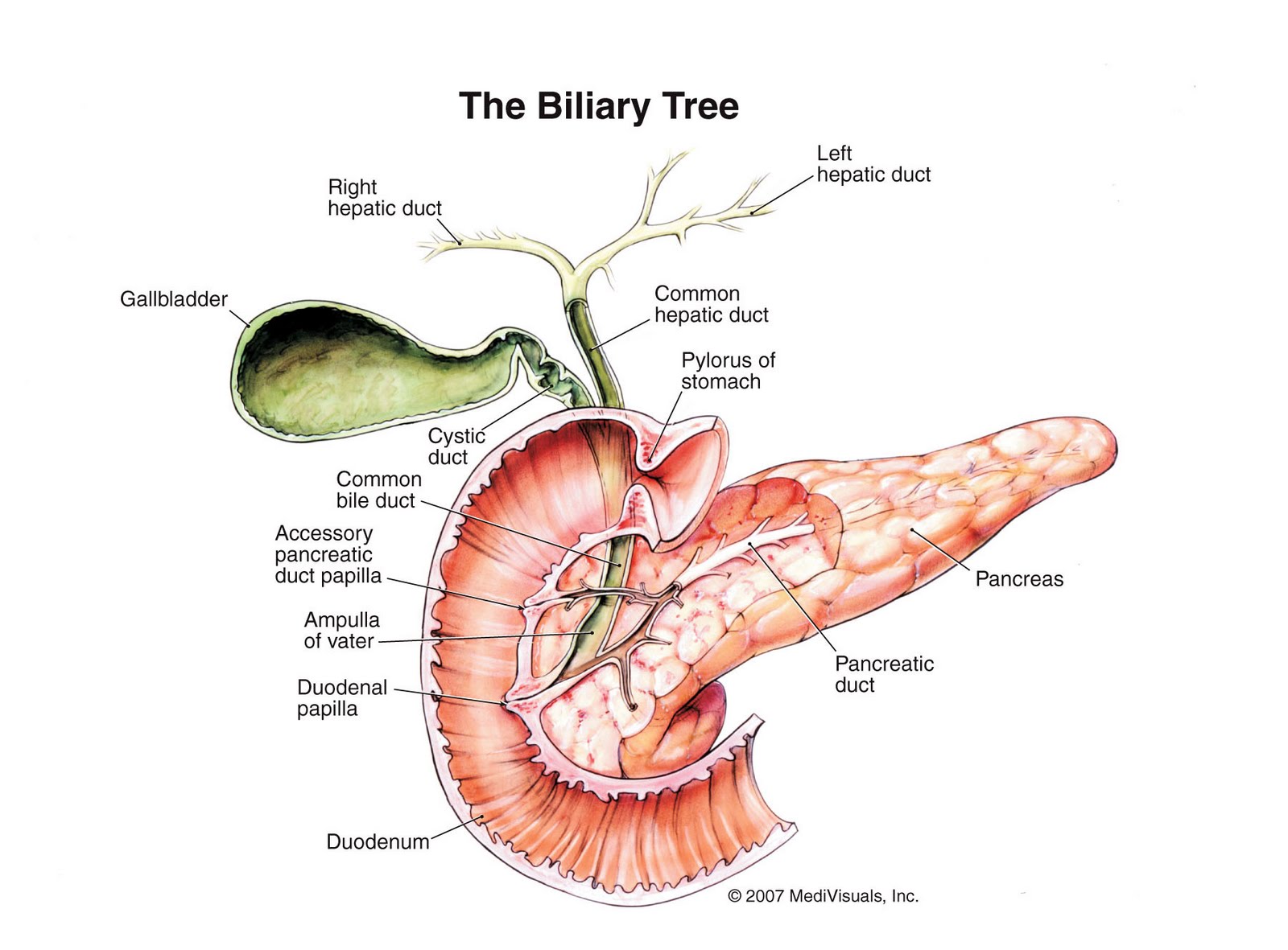 Bile Duct Obstruction