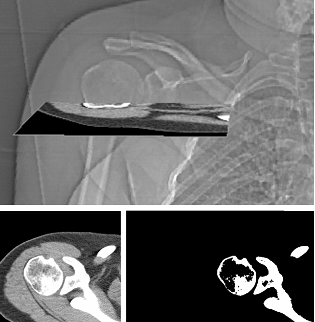 What Is Another Term For Bicipital Groove at Marjorie Thibodeau blog