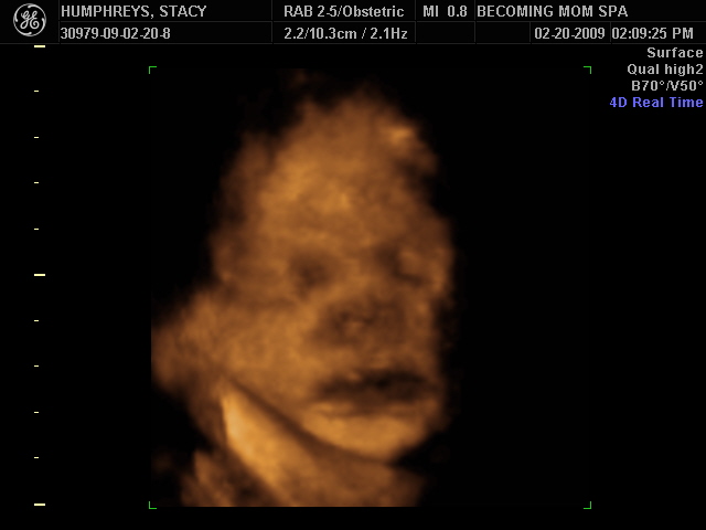 [BABY_8.JPG]