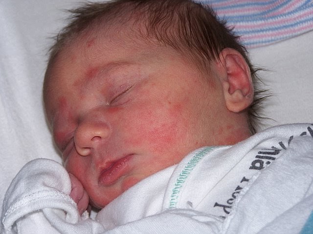 Not Wifezilla The Birthmark &amp; The Bump