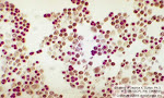 Saccharomyces cerevisiae