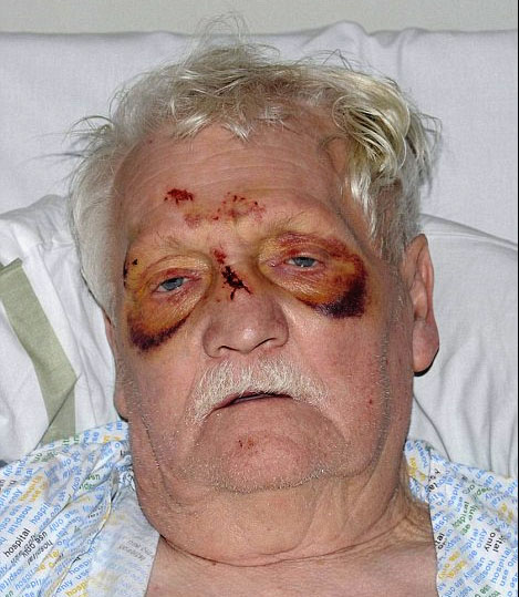 Pensioner_headbutted.jpg