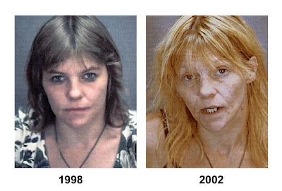 PHYSICAL AFFECTS OF DRUG ABUSE