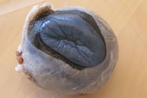 Cut Open Eye