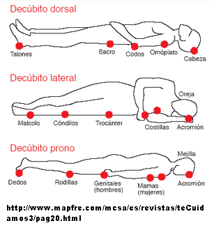 [13_decubito+blog.gif]