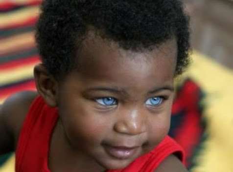  of black kids with blue eyes commenting on the children's beauty