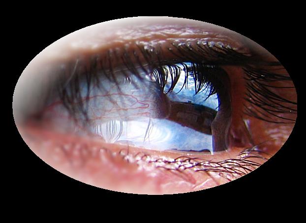 [44228965_crying_eye2.JPG]