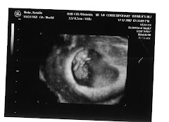 Baby Mohr @ 10 weeks