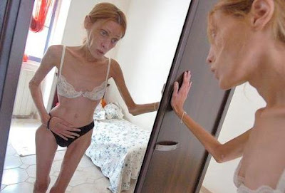 isabelle caro modelo francesa anorexica