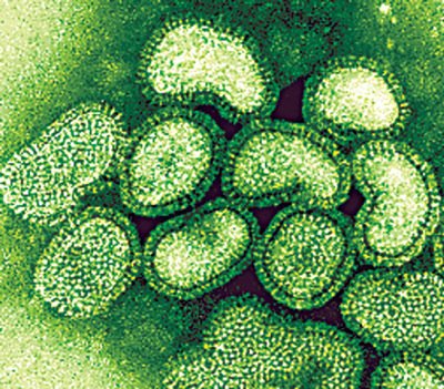 [swine+flu+H1N1.jpg]