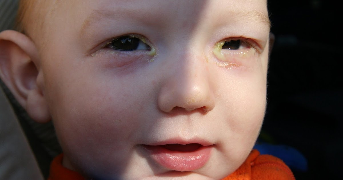 Embracing my Cup Happy 6 months, Sweet Mr. Goopy Eyes