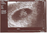 Baby Hale 7 Wk Ultrasound - 4/29/2009