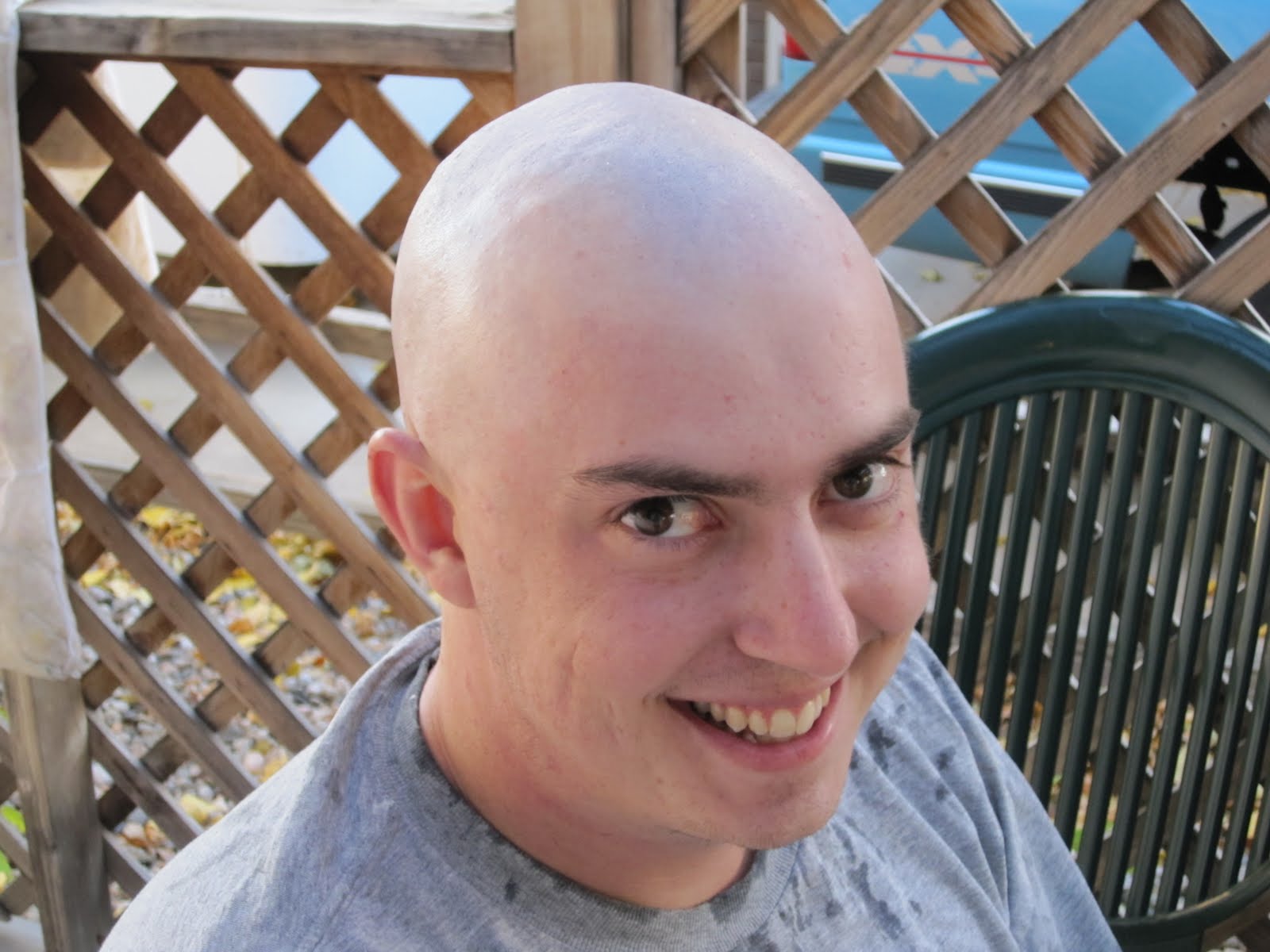 The Journey of Testicular Cancer Hair Loss and Head Shave