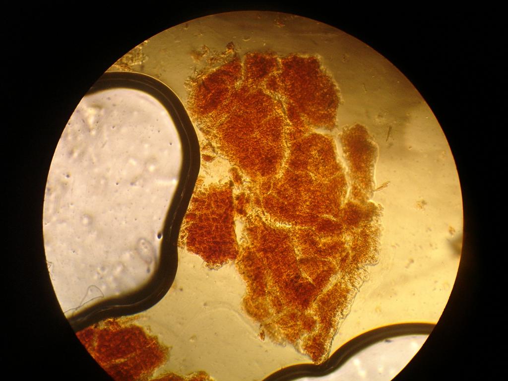 capsicum as seen under microscope