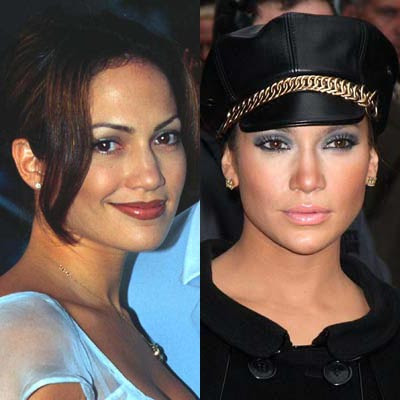 Jennifer Aniston Before and After » Jennifer Lopez Nose Job